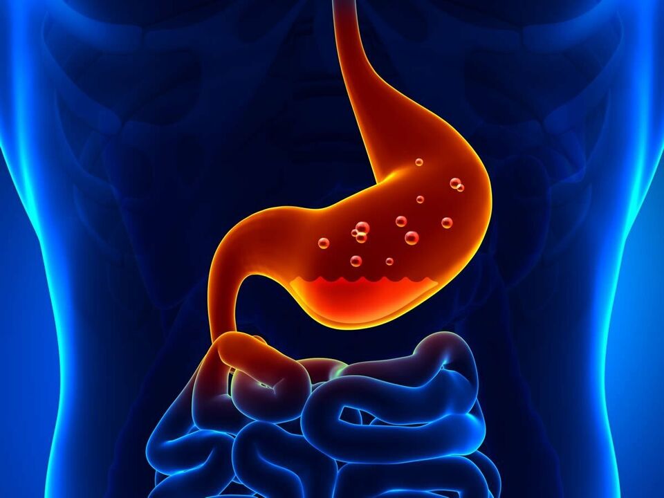 La gastrite est une maladie inflammatoire de l'estomac qui nécessite